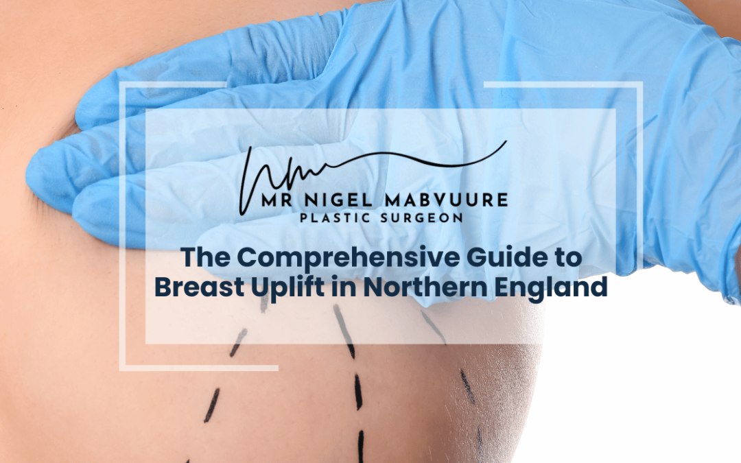 The Comprehensive Guide to Breast Uplift in Northern England