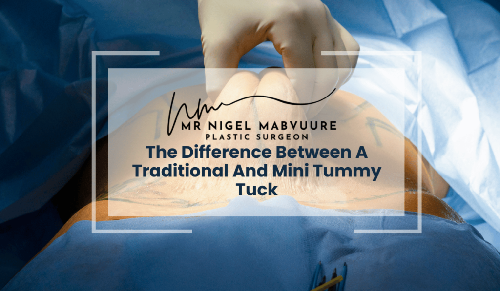 Mini vs Full Tummy Tuck