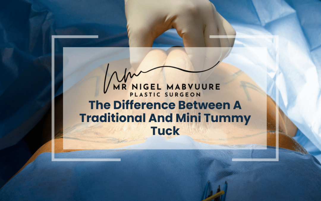The Difference Between A Traditional And Mini Tummy Tuck