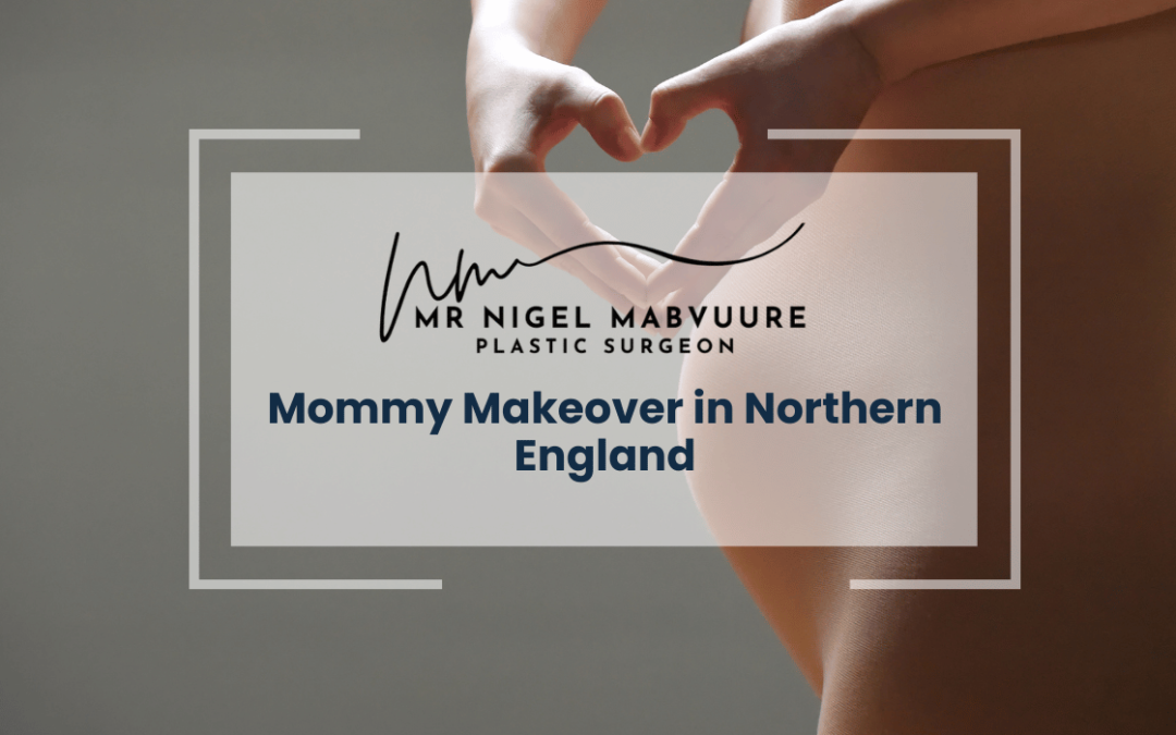 Mommy Makeover in Northern England