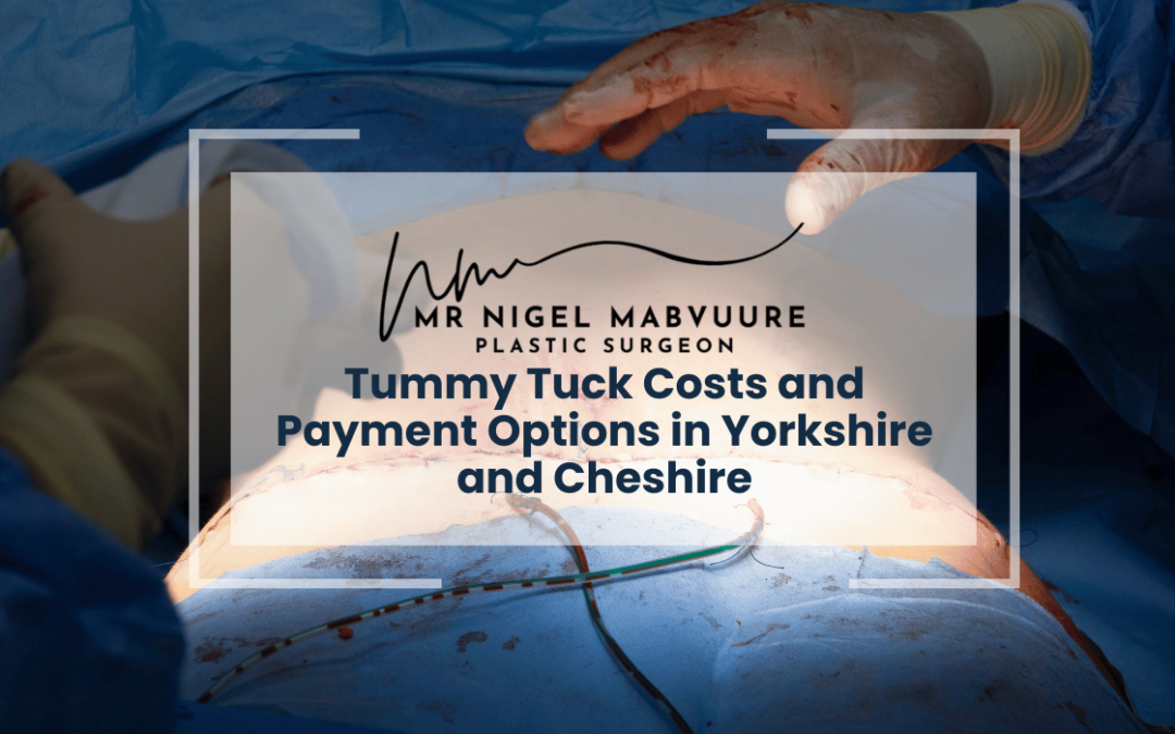 Understanding Tummy Tuck Costs and Payment Options in Yorkshire and Cheshire
