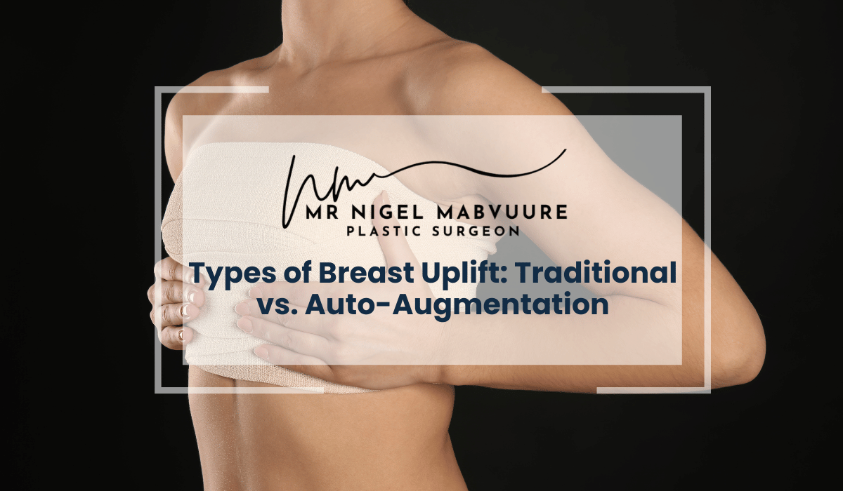 Auto Augmentation img