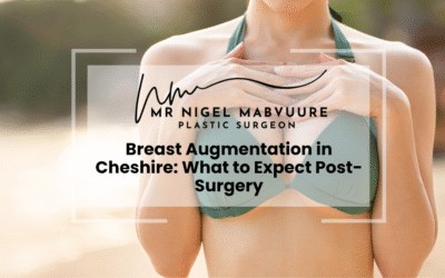 The 450cc Moderate Plus Difference: Why Dual Plane is Key to Your Dream Décolletage