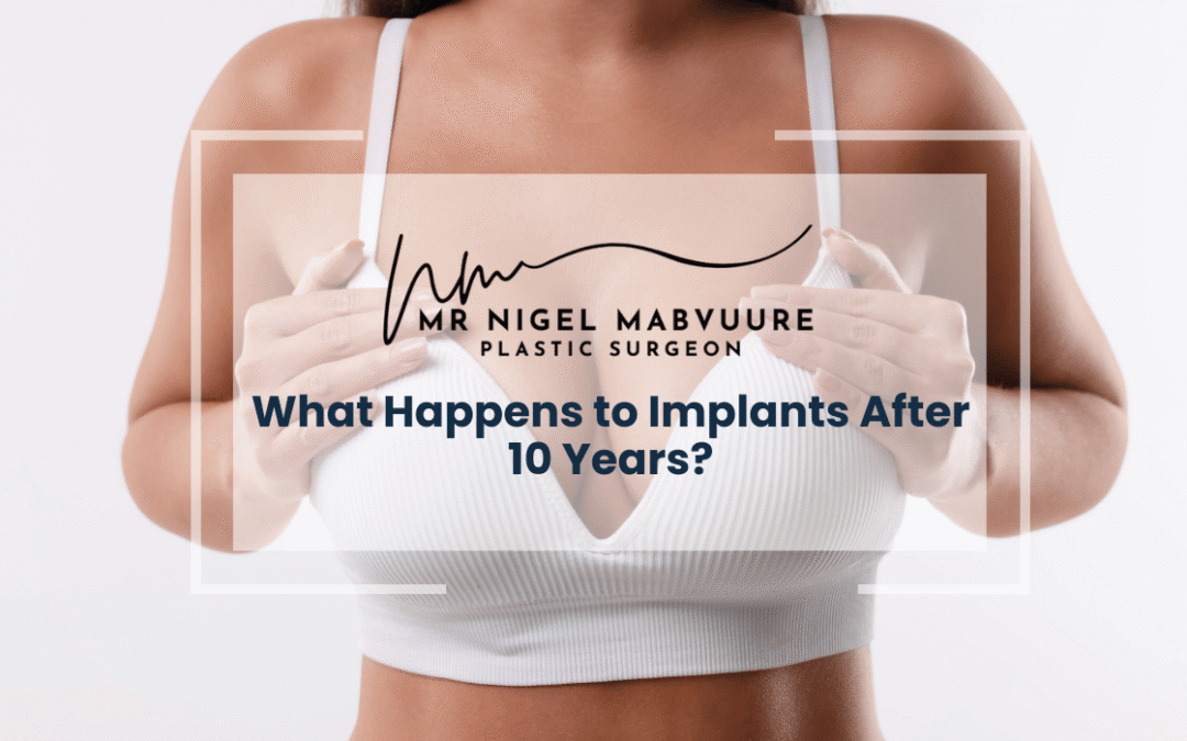 What Happens to Implants After 10 Years?
