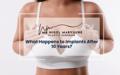 What Happens to Implants After 10 Years?