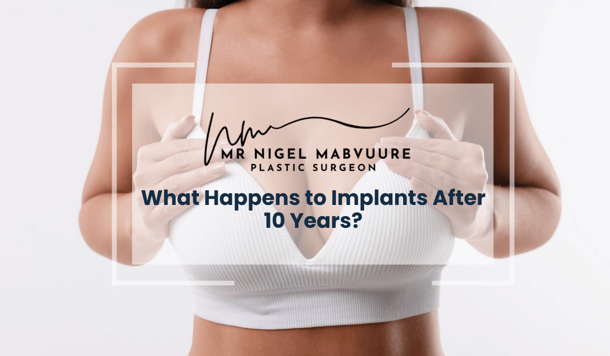  Implants After 10 Years