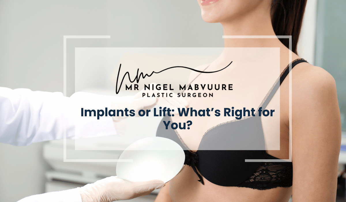 Implants or Lift
