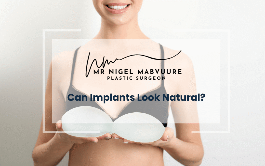Can Implants Look Natural?