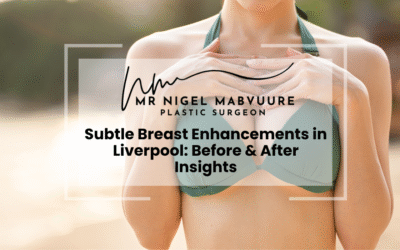 Subtle Breast Enhancements in Liverpool: Before & After Insights