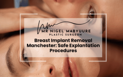 Breast Implant Removal Manchester: Safe Explantation Procedures