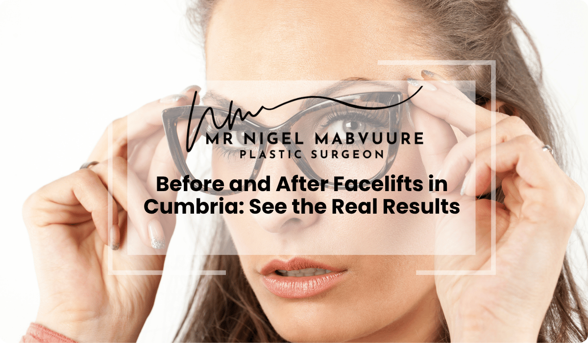 facelift before after cumbria real results 2025