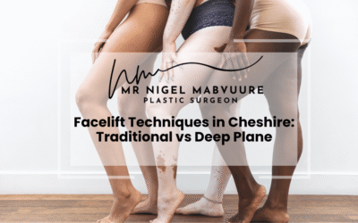 Facelift Techniques in Cheshire: Traditional vs Deep Plane