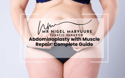Abdominoplasty with Muscle Repair: Complete Guide