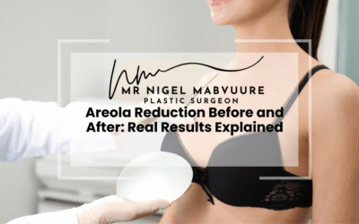 Areola Reduction Before and After: Real Results Explained