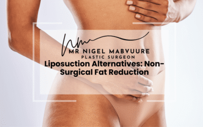 Liposuction Alternatives: Non-Surgical Fat Reduction