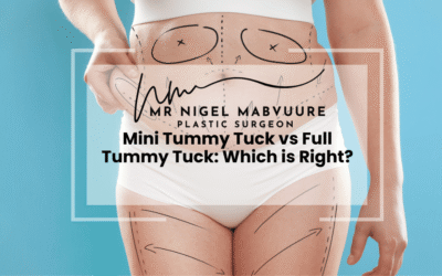 Mini Tummy Tuck vs Full Tummy Tuck: Which is Right?