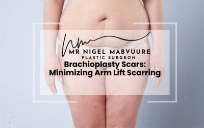 Brachioplasty Scars: Minimizing Arm Lift Scarring