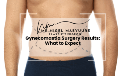 What to Expect After Gynecomastia Surgery: Results, Recovery and Reality