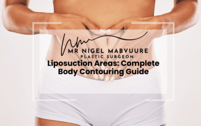 Liposuction Areas: Complete Body Contouring Guide