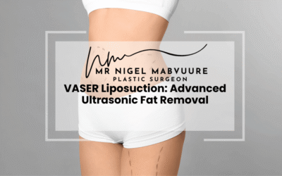 VASER Liposuction: Advanced Ultrasonic Fat Removal
