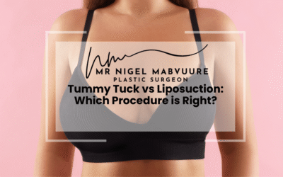 Tummy Tuck vs Liposuction: Which Procedure is Right?