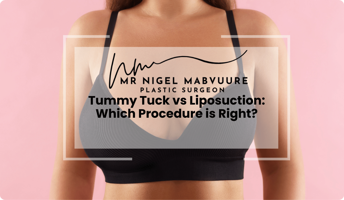 tummy tuck vs liposuction comparison