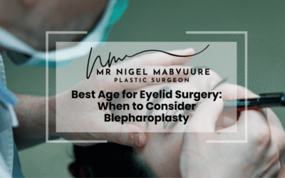 Best Age for Eyelid Surgery: When to Consider Blepharoplasty