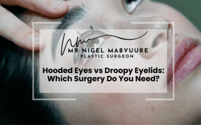 Hooded Eyes vs Droopy Eyelids: Which Surgery Do You Need?