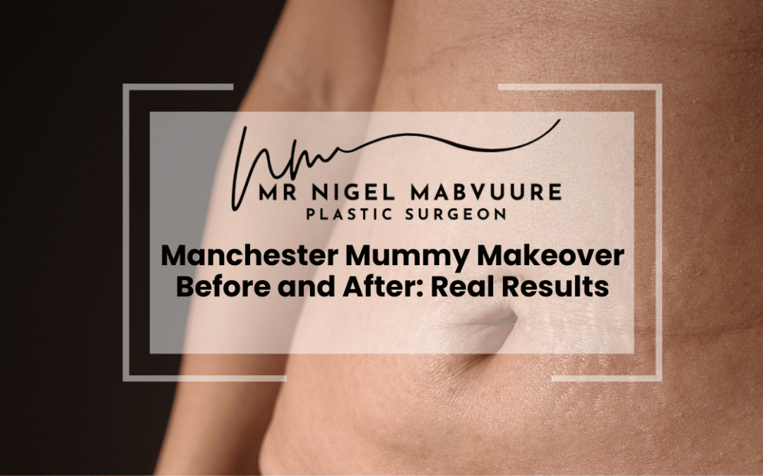 Manchester Mummy Makeover Before and After: Real Results