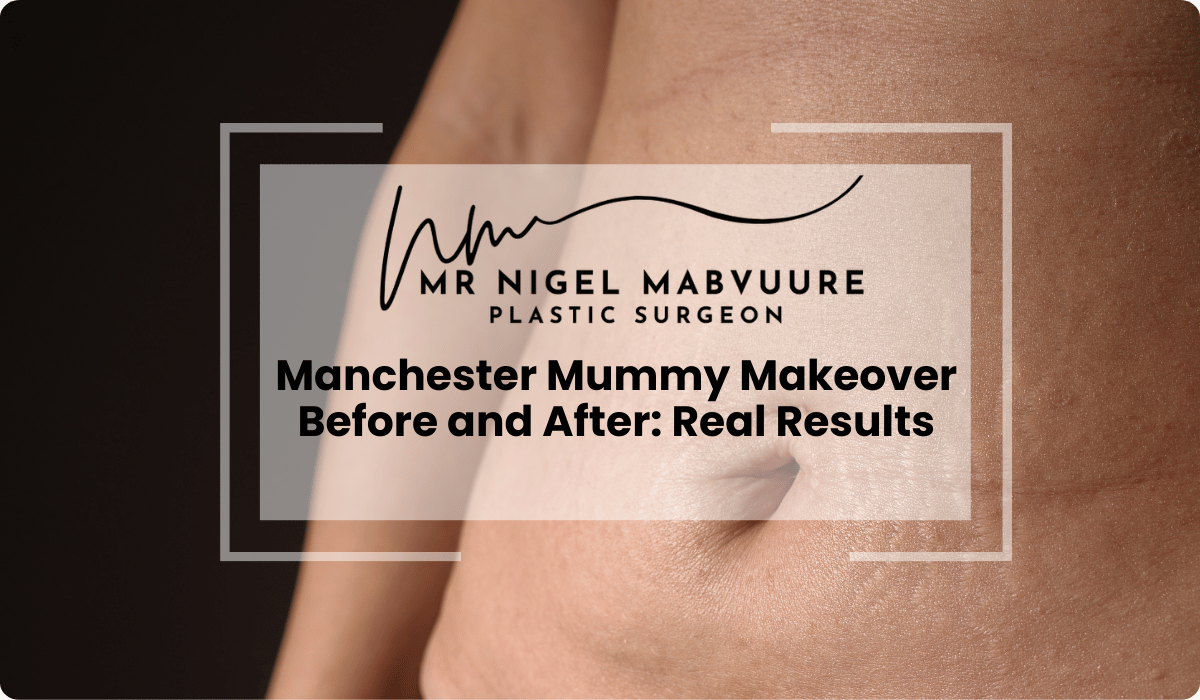 manchester mummy makeover before after real results
