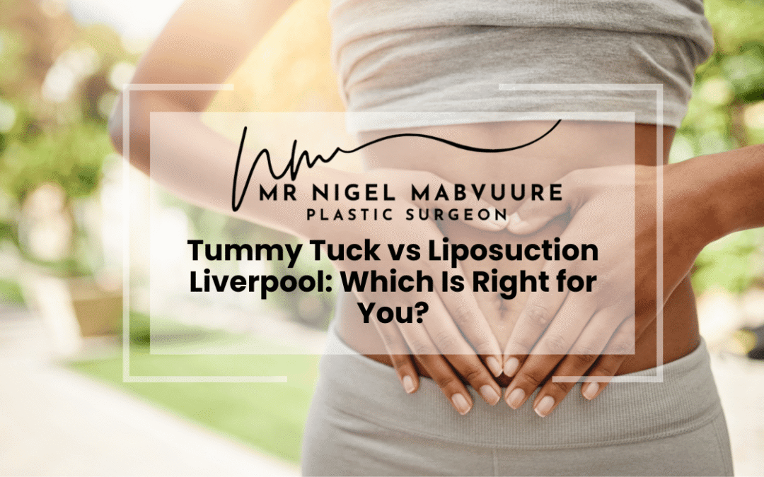 Tummy Tuck vs Liposuction Liverpool: Which Is Right for You?