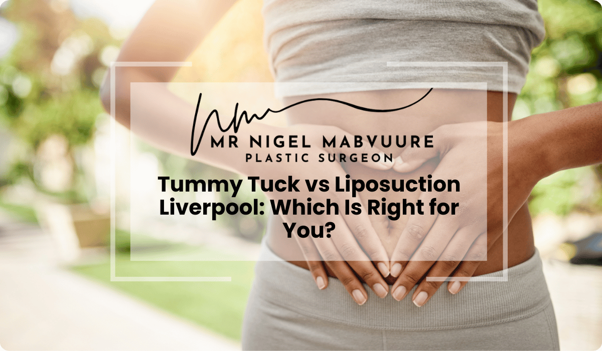 ngo-illustration-Artboard 5 tummy tuck vs liposuction liverpool right choice