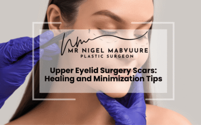 Upper Eyelid Surgery Scars: Healing and Minimization Tips