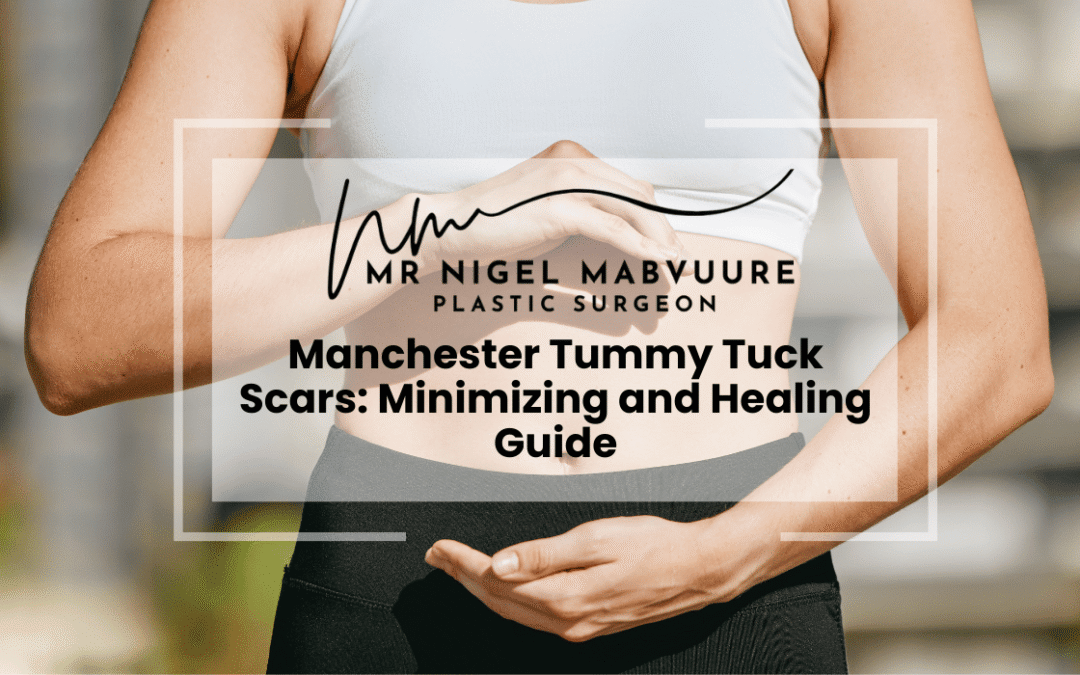 Manchester Tummy Tuck Scars: Minimizing and Healing Guide