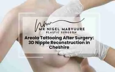Areola Tattooing After Surgery: 3D Nipple Reconstruction in Cheshire