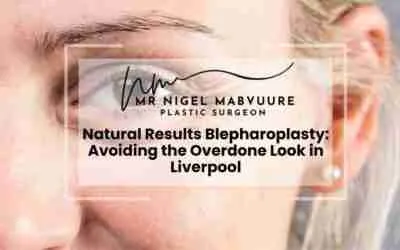 Natural Results Blepharoplasty: Avoiding the Overdone Look in Liverpool