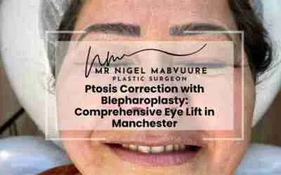 Ptosis Correction with Blepharoplasty: Comprehensive Eye Lift in Manchester